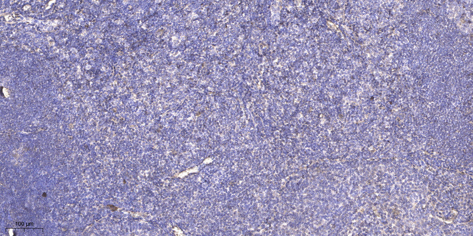 RPAB4 Rabbit Polyclonal Antibody