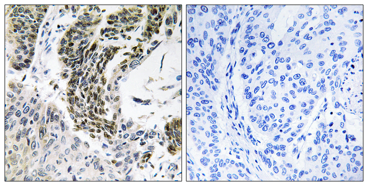 RREB1 Rabbit Polyclonal Antibody
