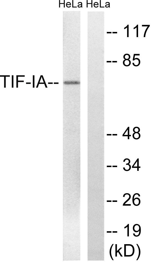 Rrn3 Rabbit Polyclonal Antibody
