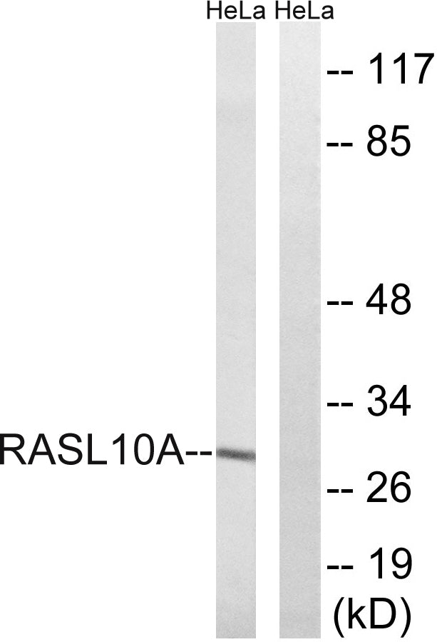 RRP22 Rabbit Polyclonal Antibody