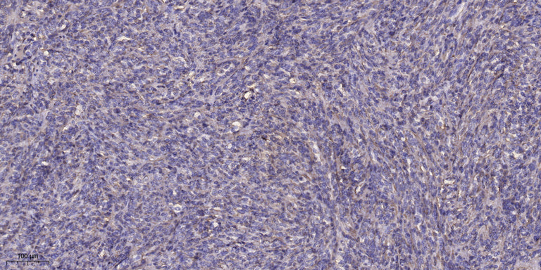 S100A7 Rabbit Polyclonal Antibody