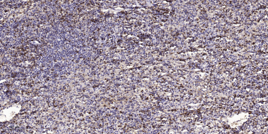 S100A7A Rabbit Polyclonal Antibody