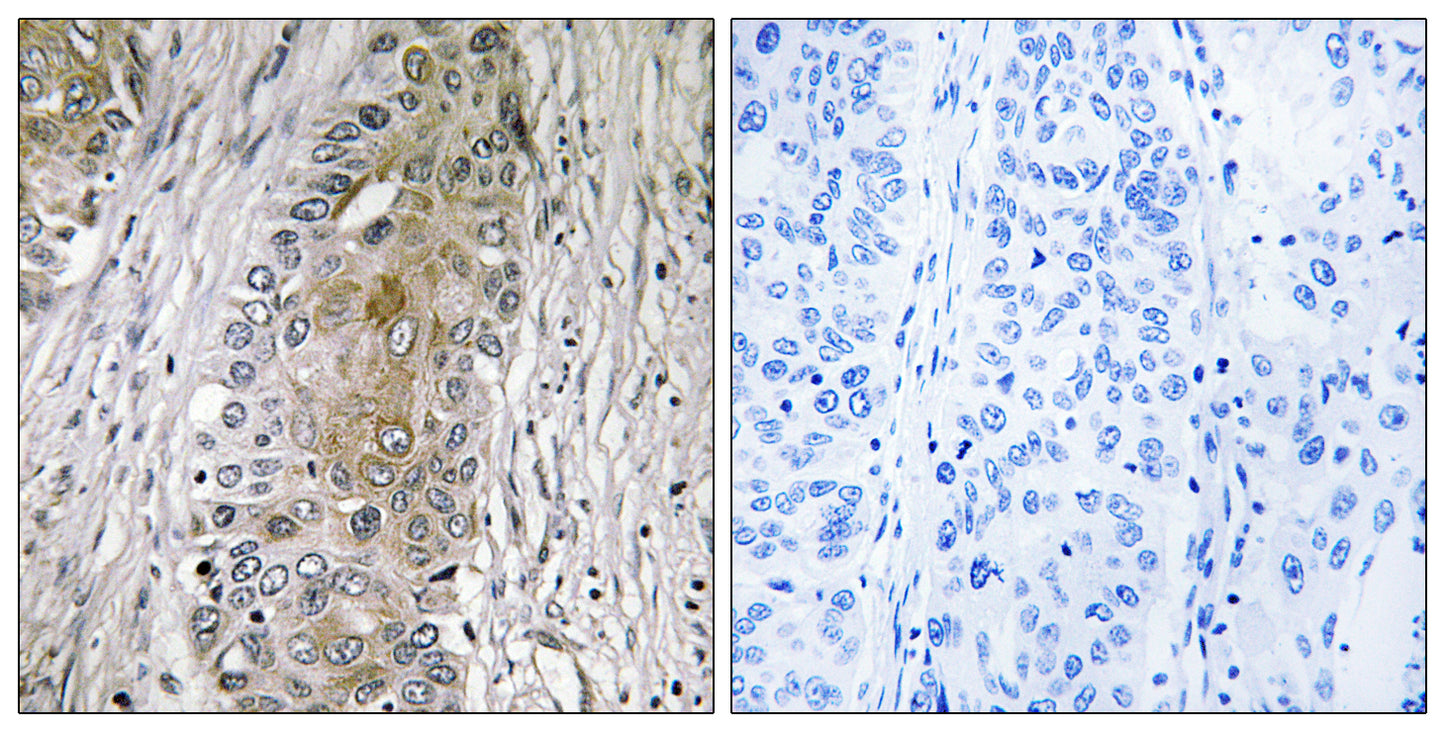 SAA4 Rabbit Polyclonal Antibody