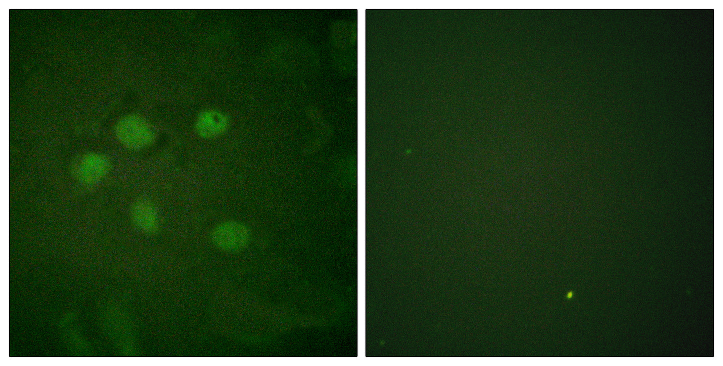 SAE1 Rabbit Polyclonal Antibody
