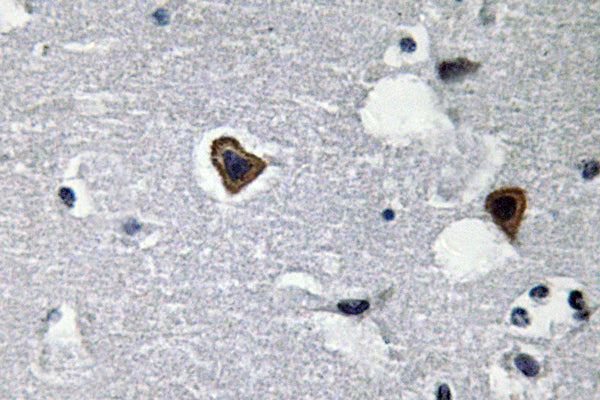 Sarcoglycan-β Rabbit Polyclonal Antibody