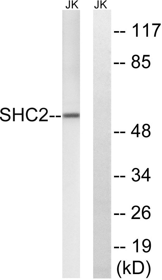 Sck Rabbit Polyclonal Antibody