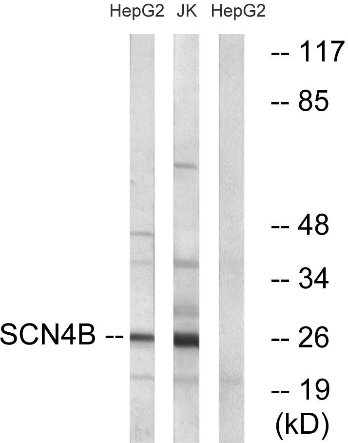 Scn4b Rabbit Polyclonal Antibody