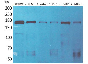 SCP-2 Rabbit Polyclonal Antibody