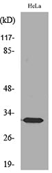 SDHB Rabbit Polyclonal Antibody