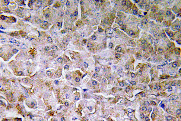 SEMA3C Rabbit Polyclonal Antibody