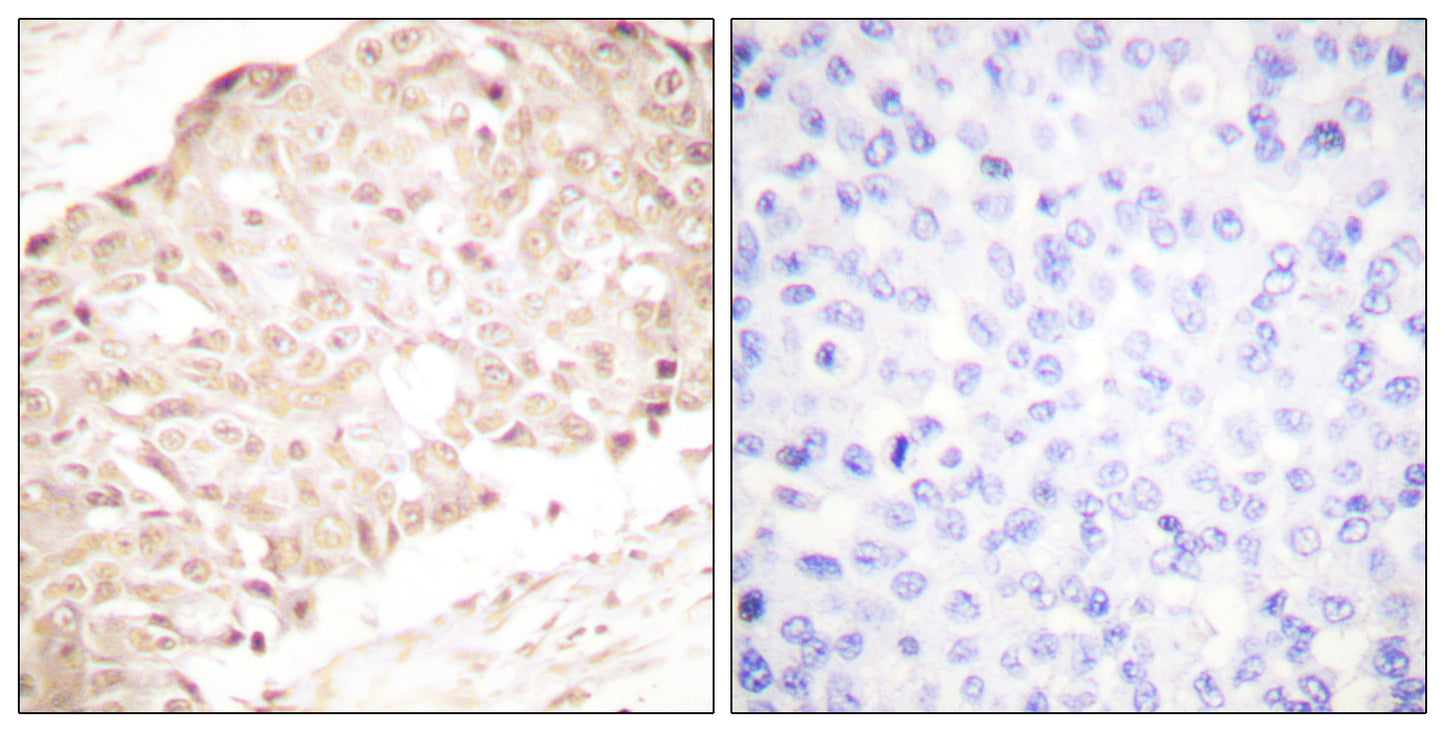 SENP1 Rabbit Polyclonal Antibody