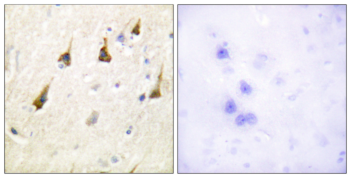 SENP7 Rabbit Polyclonal Antibody