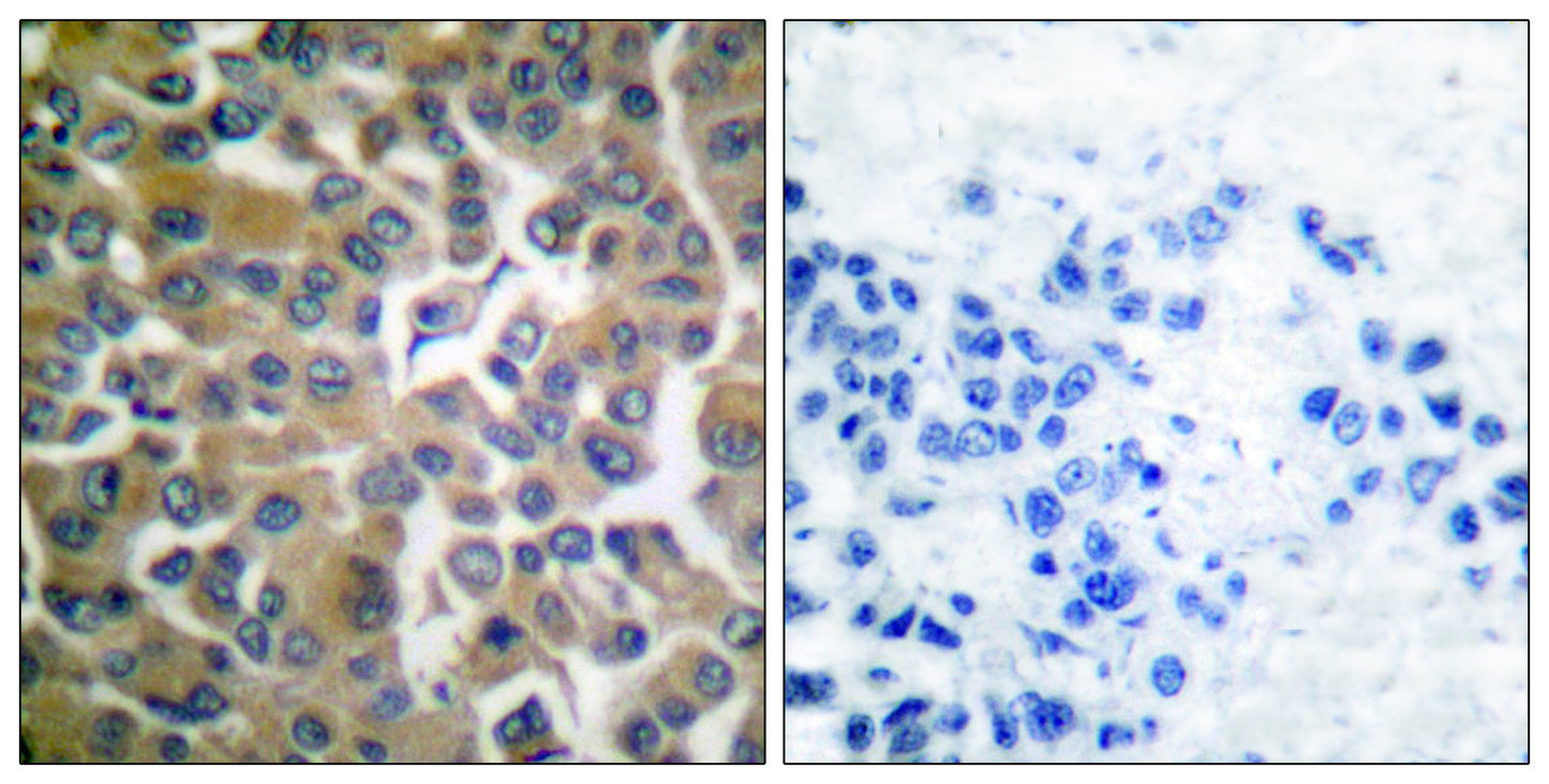 Seprase Rabbit Polyclonal Antibody