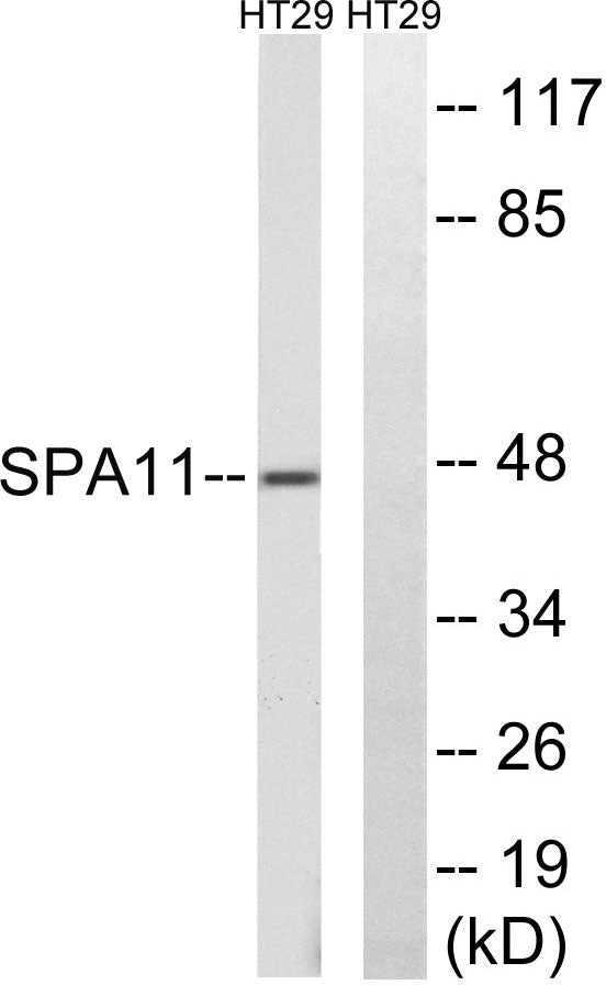 Serpin A11 Rabbit Polyclonal Antibody