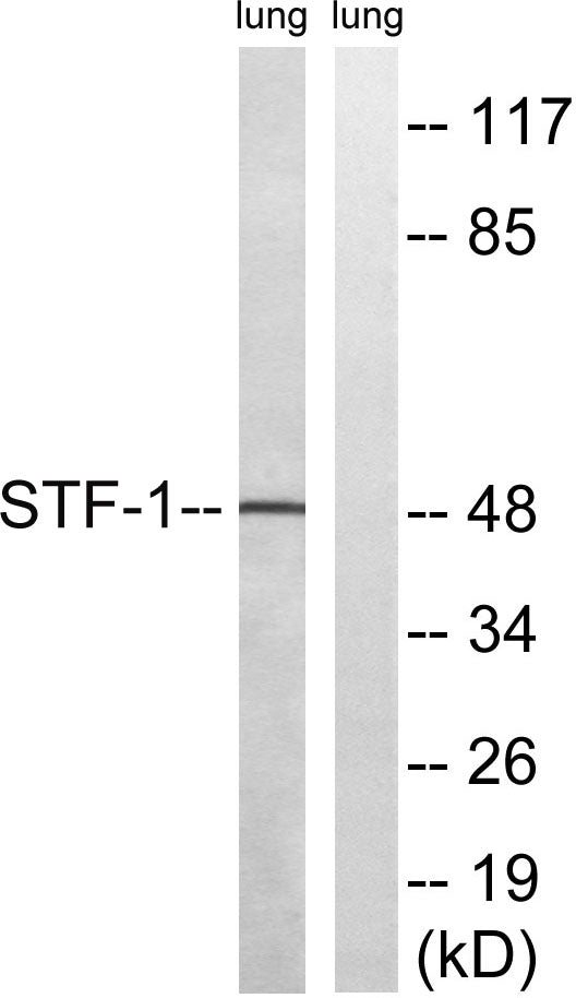 SF-1 Rabbit Polyclonal Antibody