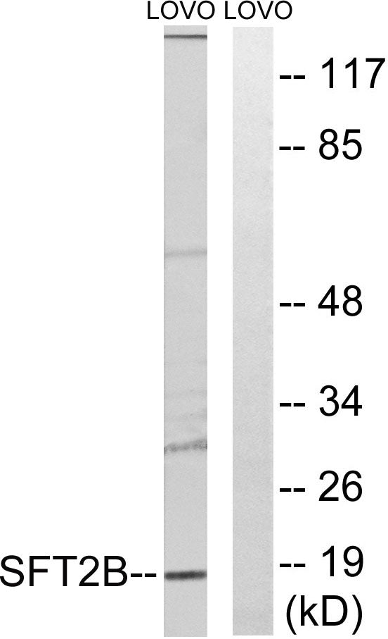SFT2D2 Rabbit Polyclonal Antibody