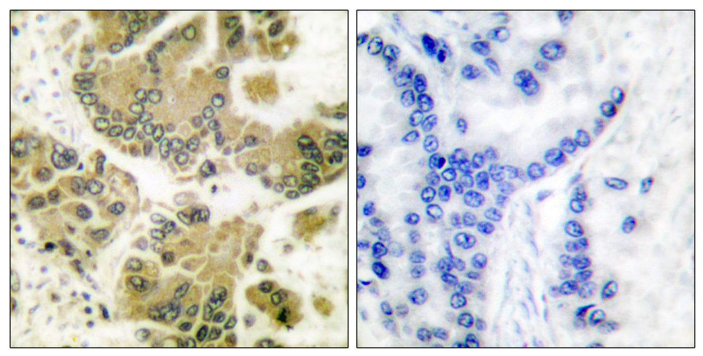 SGK1 Rabbit Polyclonal Antibody