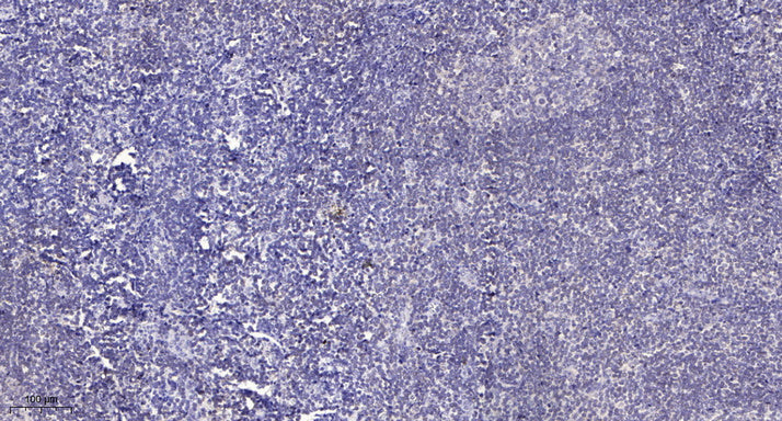 SH3BGRL3 Rabbit Polyclonal Antibody
