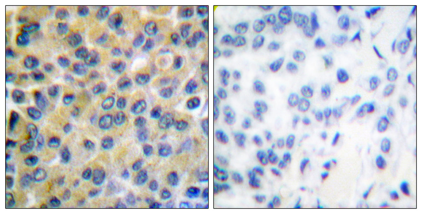 SH-PTP2 Rabbit Polyclonal Antibody
