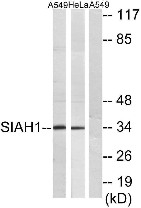 Siah-1/2 Rabbit Polyclonal Antibody