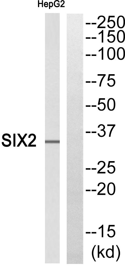 Six2 Rabbit Polyclonal Antibody
