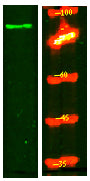 SL9A2 Rabbit Polyclonal Antibody