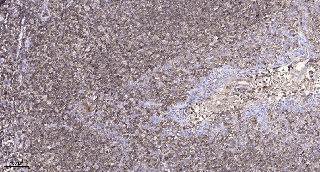 SLC10A4 Rabbit Polyclonal Antibody