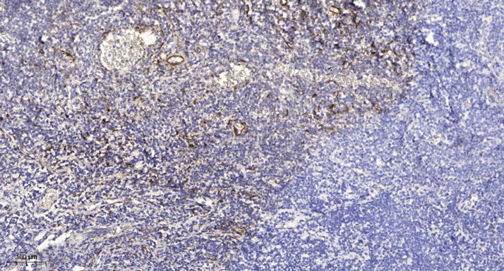 Slit3 Rabbit Polyclonal Antibody