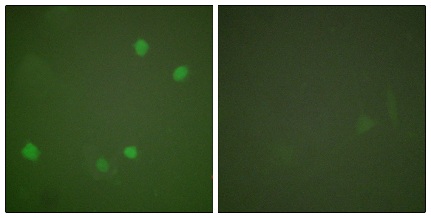 SMAP45 Rabbit Polyclonal Antibody
