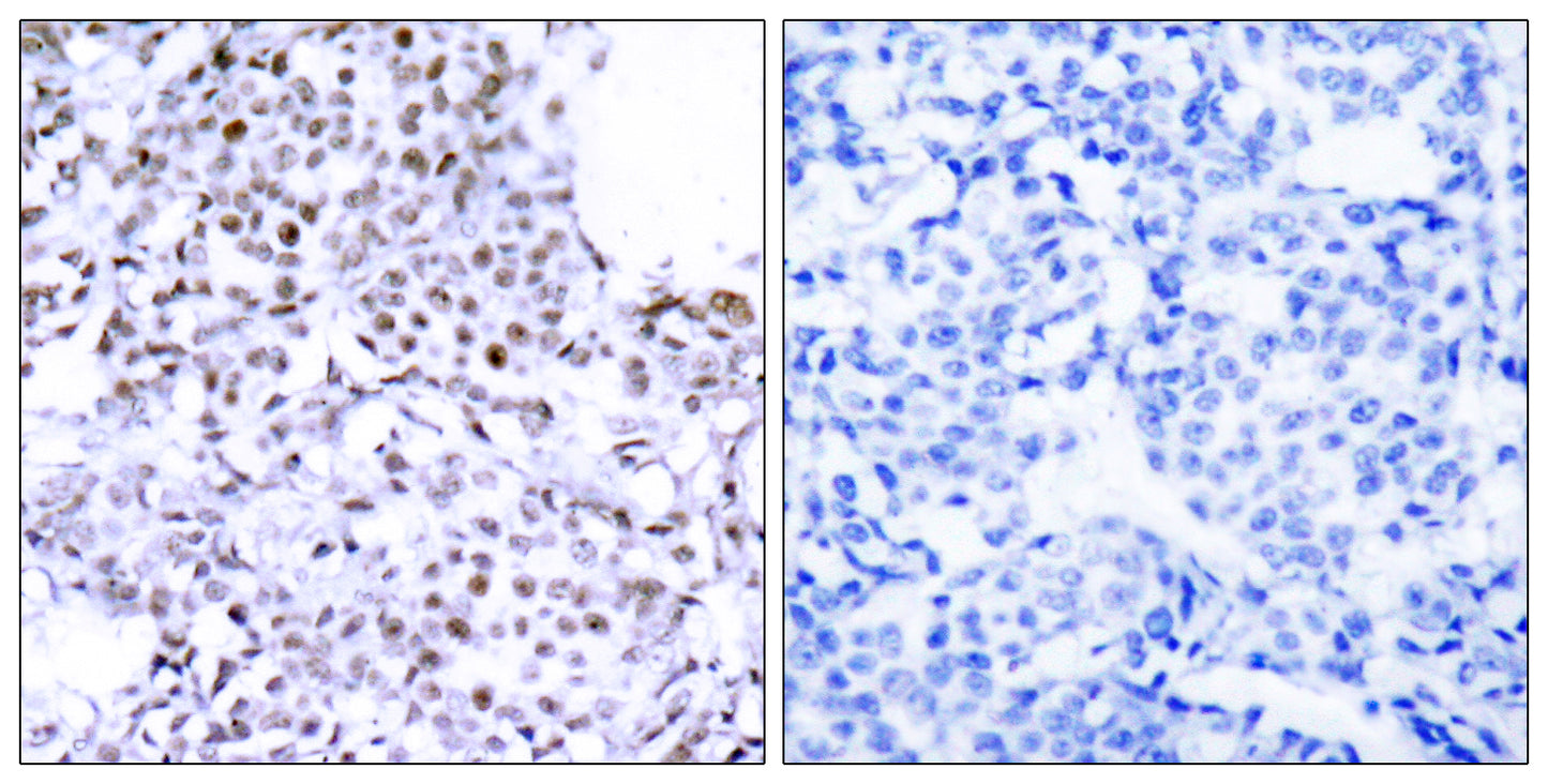 SMC1 Rabbit Polyclonal Antibody