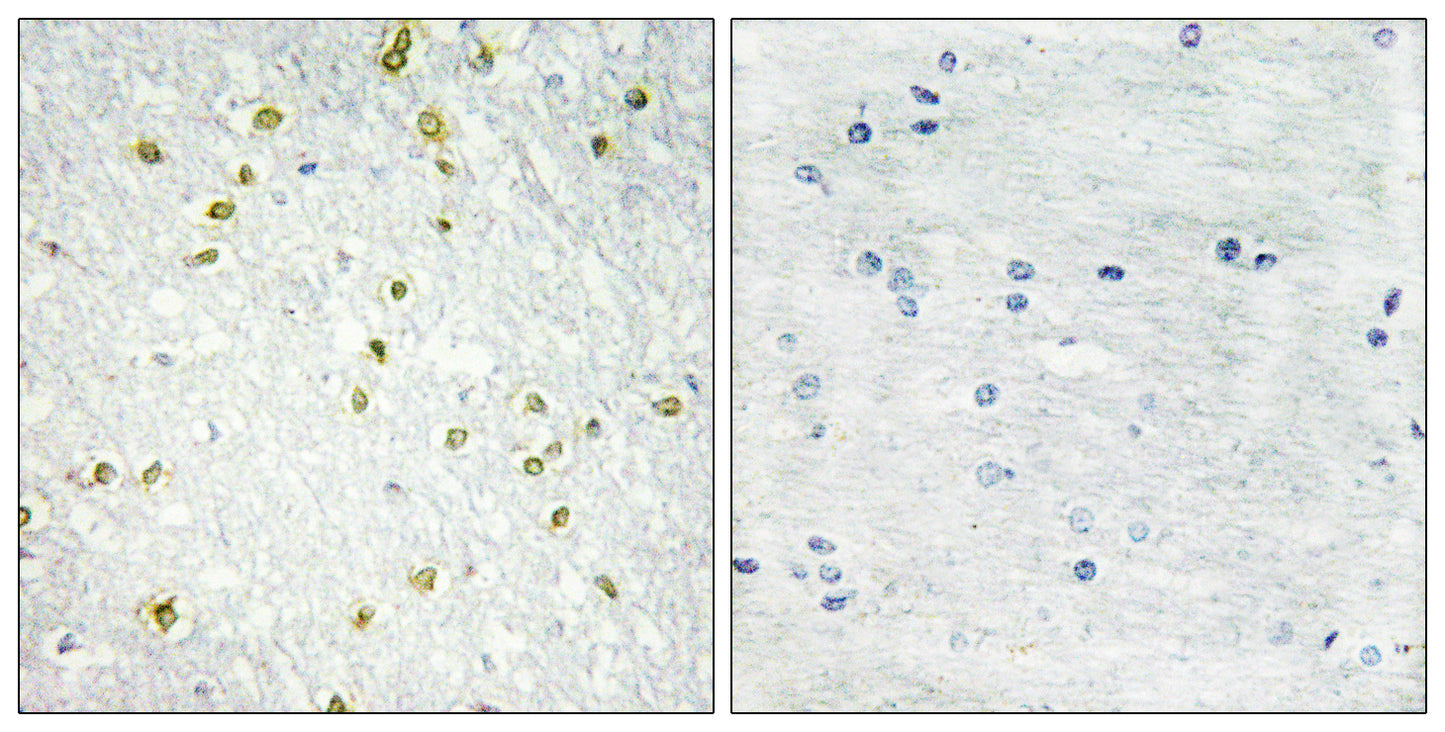 SNAPC 19 Rabbit Polyclonal Antibody