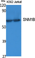 SNM1B Rabbit Polyclonal Antibody