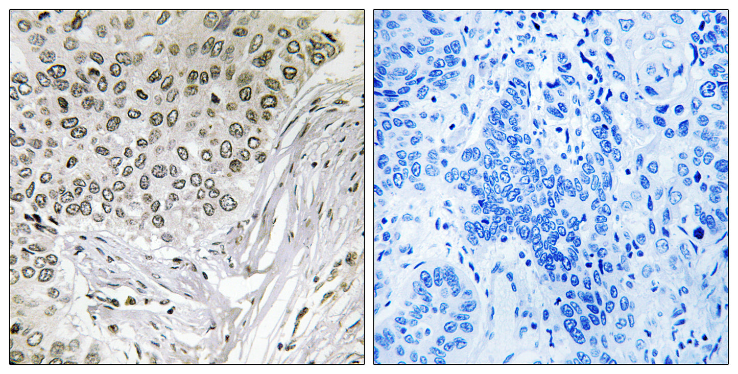 Snrp116 Rabbit Polyclonal Antibody