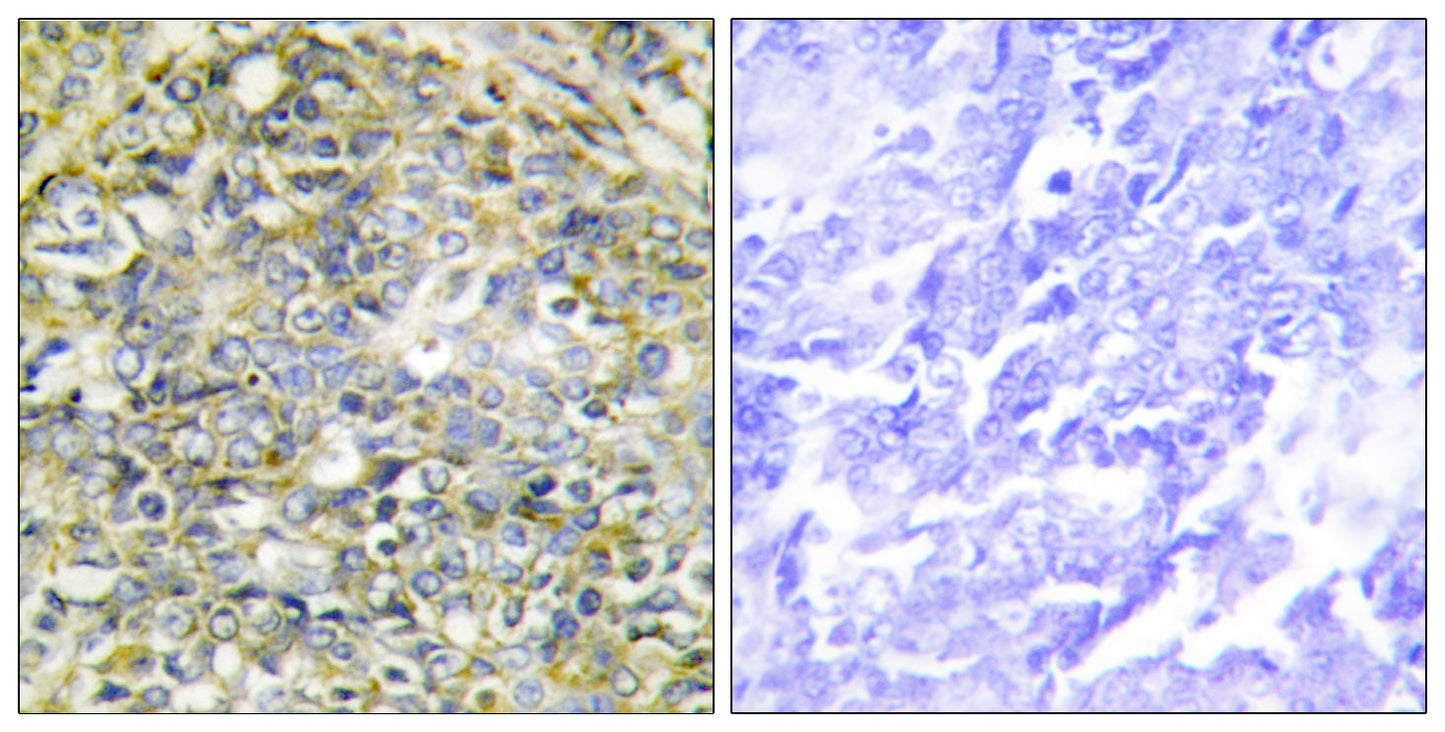 Socius Rabbit Polyclonal Antibody