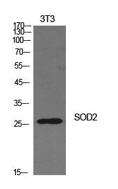 SOD-2 Rabbit Polyclonal Antibody