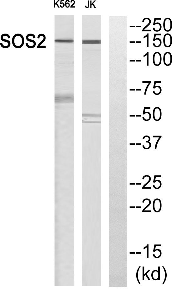 Sos 2 Rabbit Polyclonal Antibody