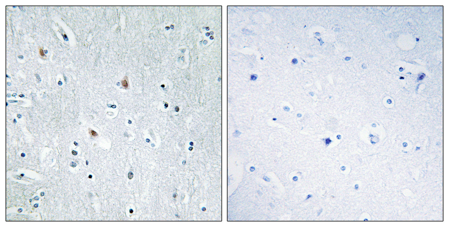 Sox-12 Rabbit Polyclonal Antibody