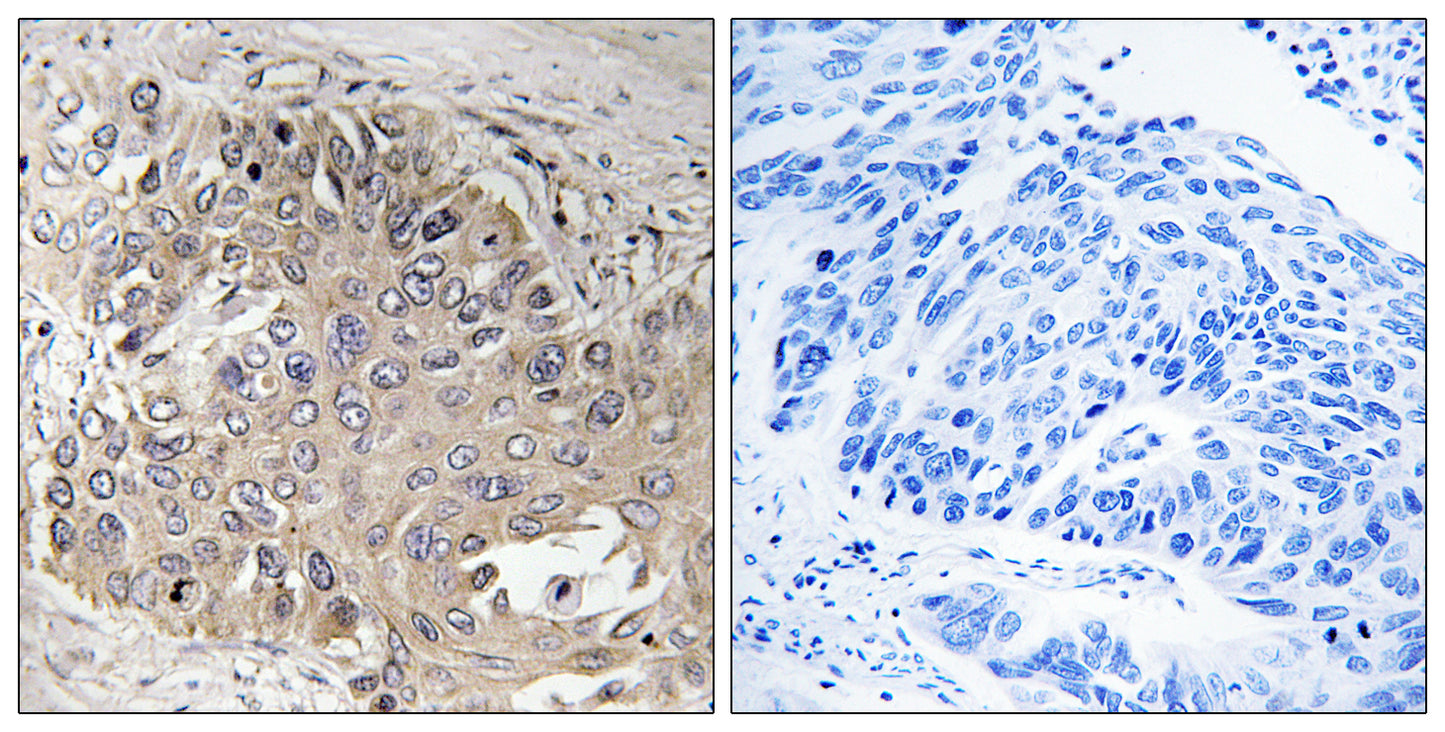 Spectrin β V Rabbit Polyclonal Antibody