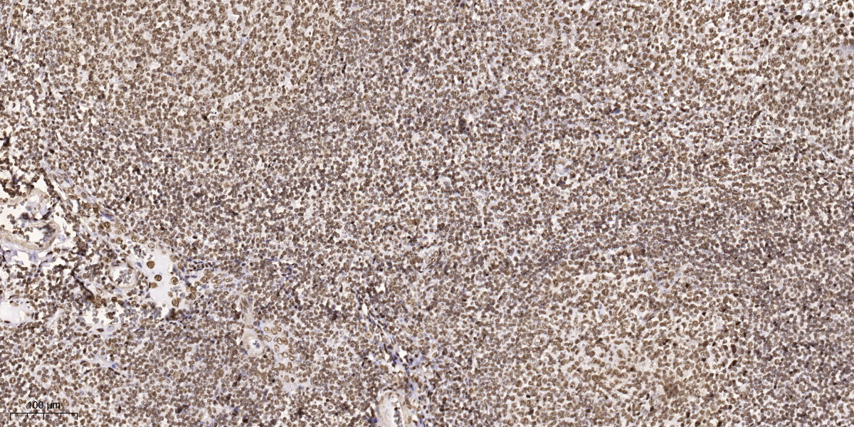 SPEG Rabbit Polyclonal Antibody
