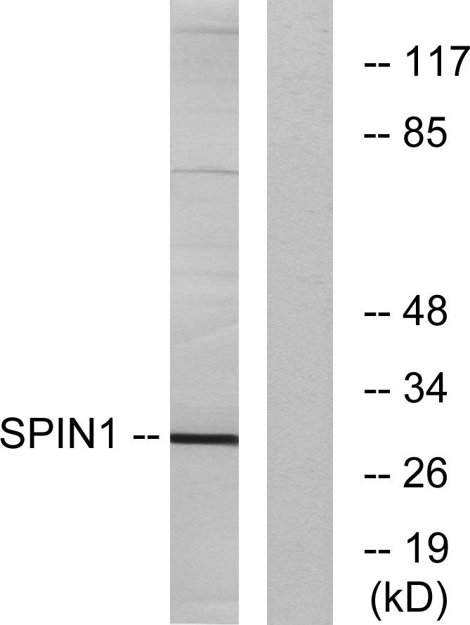 Spindlin-1 Rabbit Polyclonal Antibody