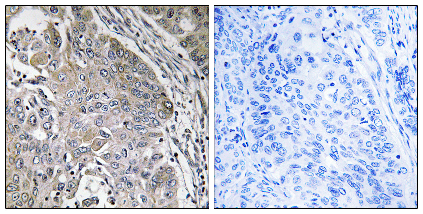 SPINK6 Rabbit Polyclonal Antibody