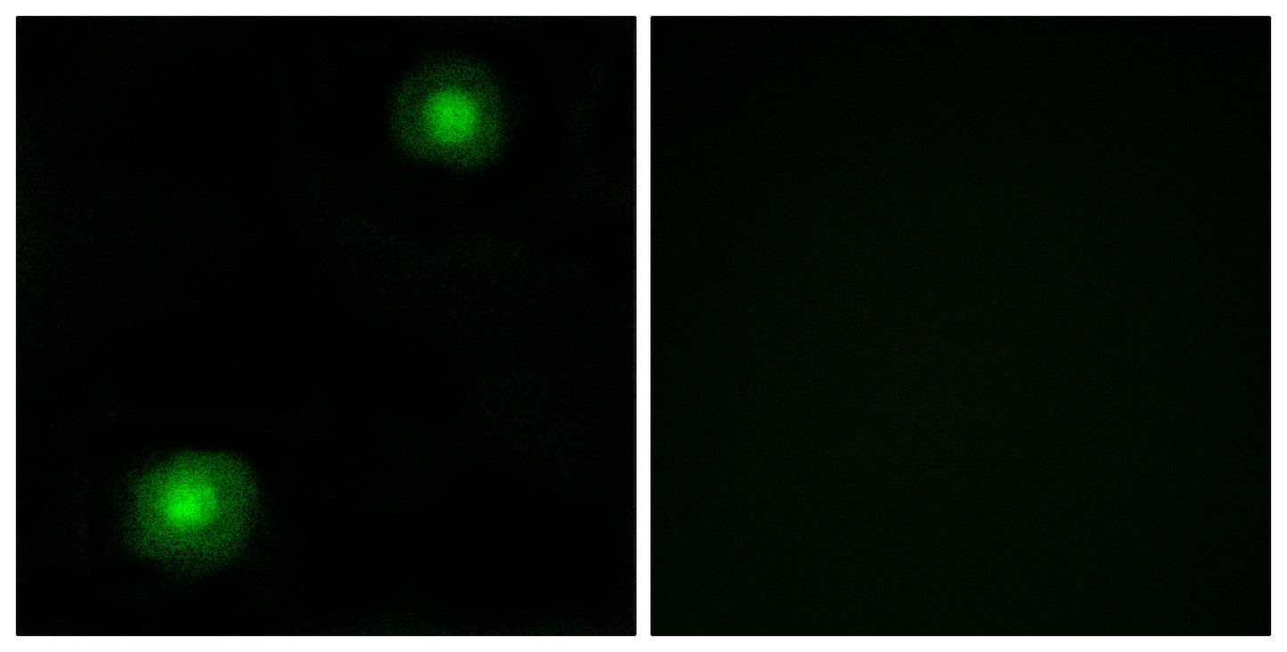 SRE-ZBP Rabbit Polyclonal Antibody