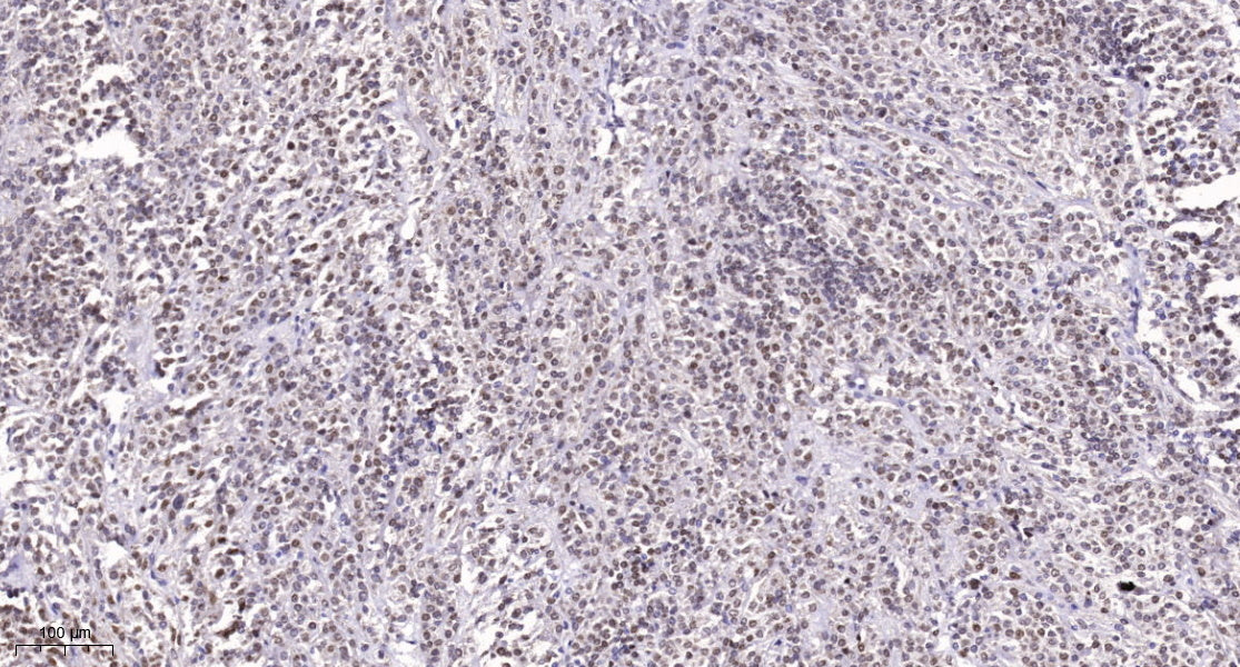 SRp55 Rabbit Polyclonal Antibody