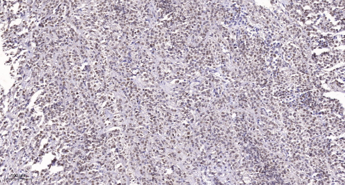 SRRM2 Rabbit Polyclonal Antibody