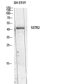 SSTR2 Rabbit Polyclonal Antibody