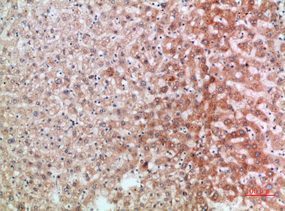 ST2 Rabbit Polyclonal Antibody