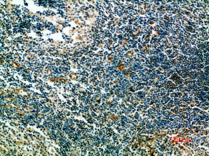 ST6GAL1 Rabbit Polyclonal Antibody