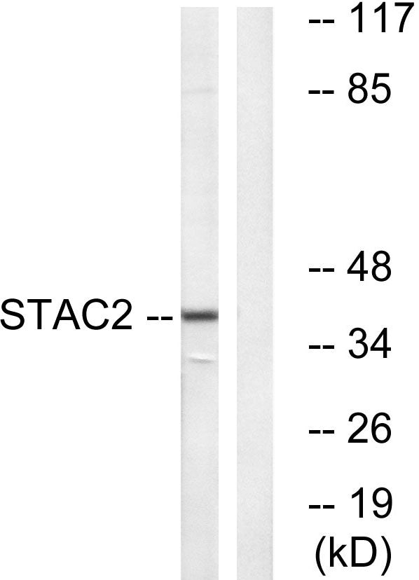 STAC2 Rabbit Polyclonal Antibody