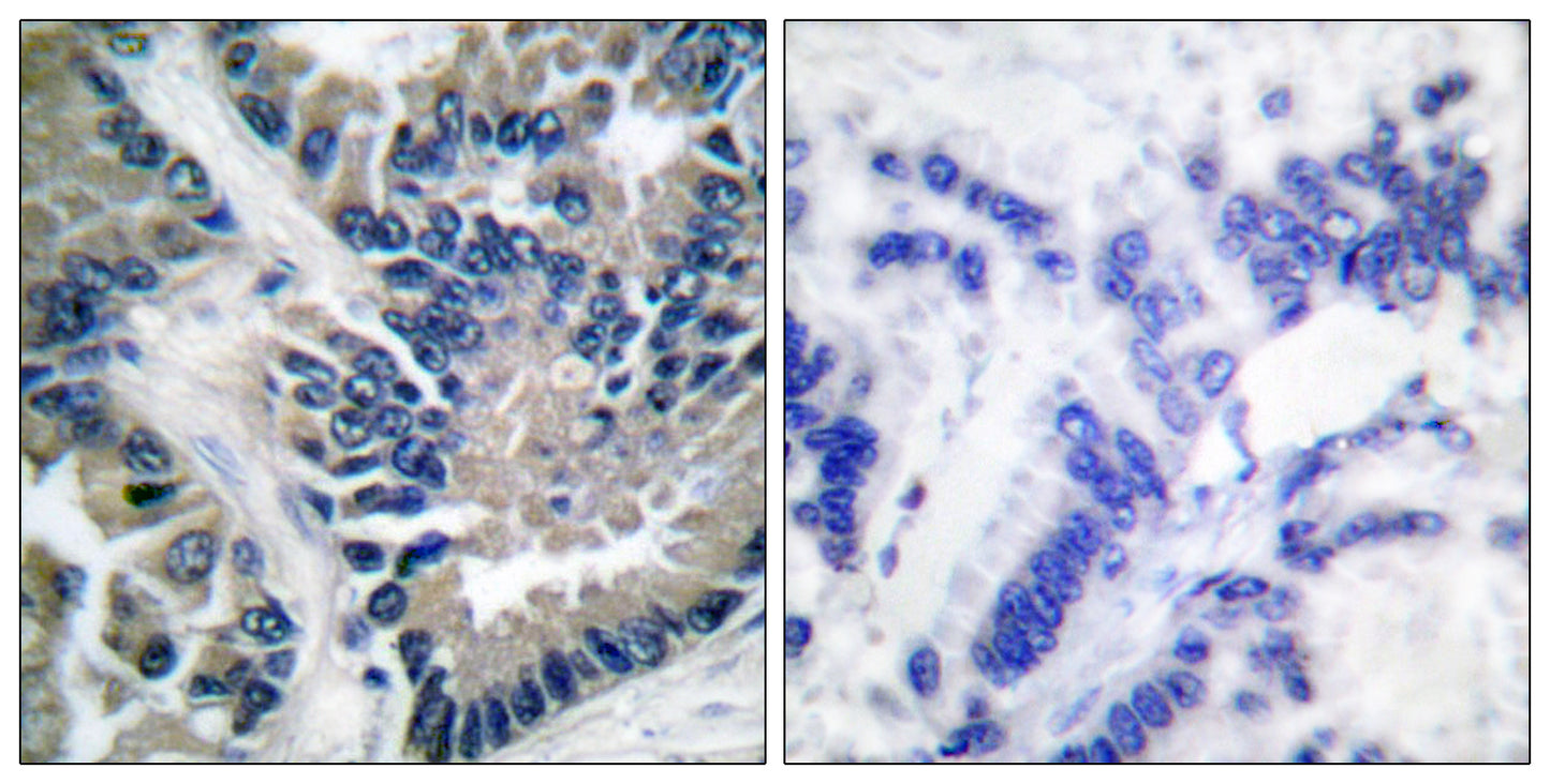 Stat2 Rabbit Polyclonal Antibody