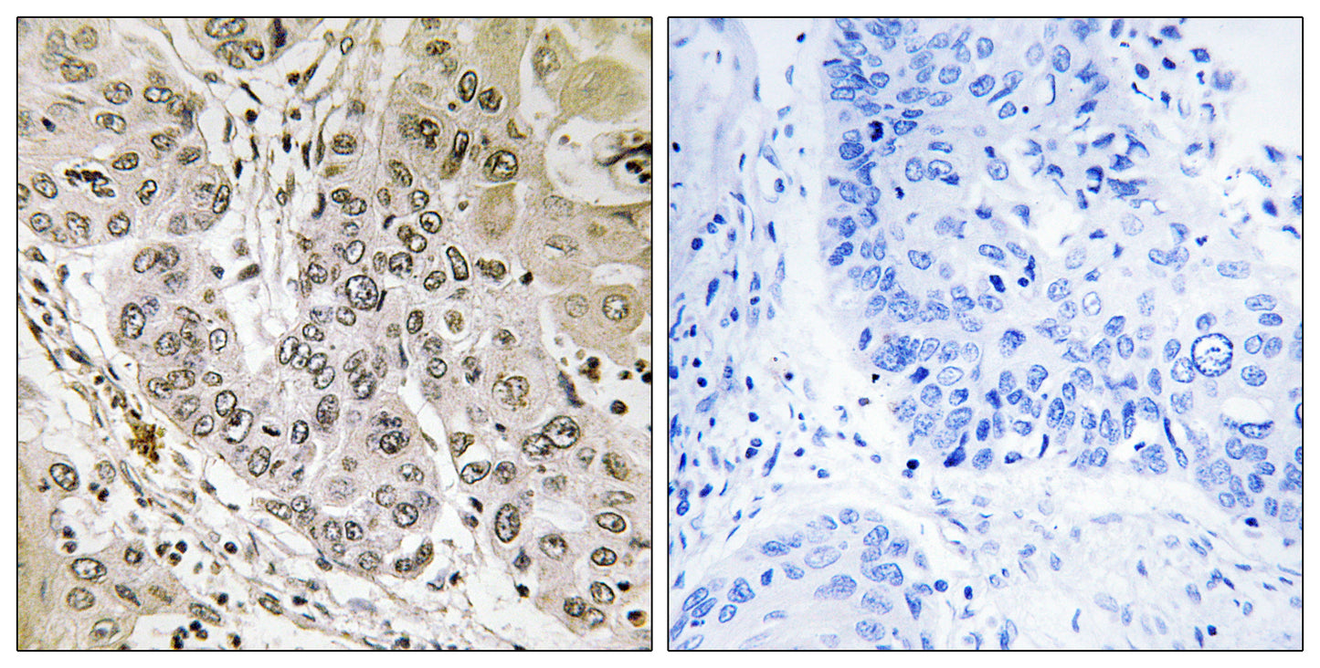 STK36 Rabbit Polyclonal Antibody